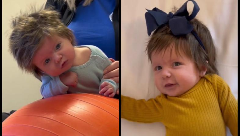 Viralen posnetek: Dojenček ima gostejše lase kot vi