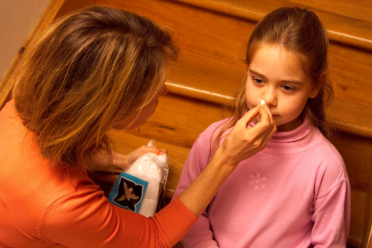 Krvavenje iz nosu pri otrocih – kaj je vzrok, kako jo ustaviti in kdaj k zdravniku