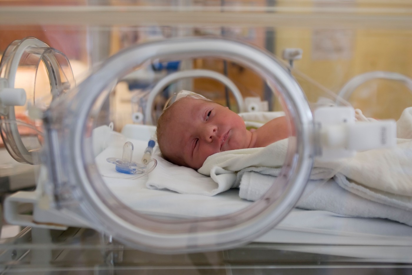 prezgodaj rojen otrok v inkubatorju