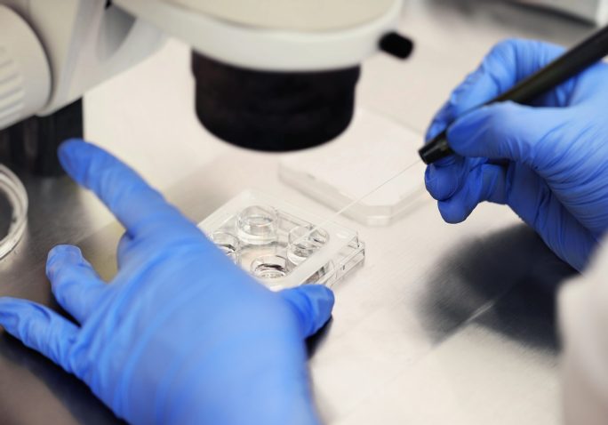 laboratorij proces umetne oploditve jajčeca na IVF kliniki
